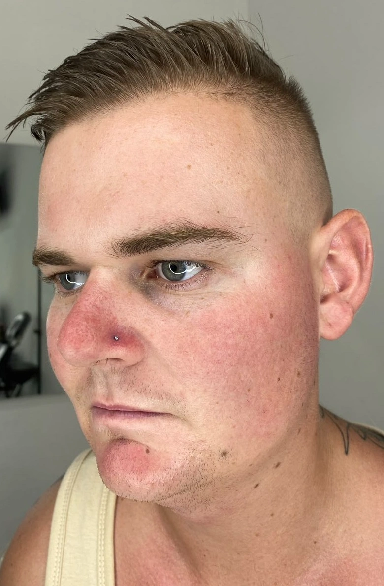 Ear Piercing